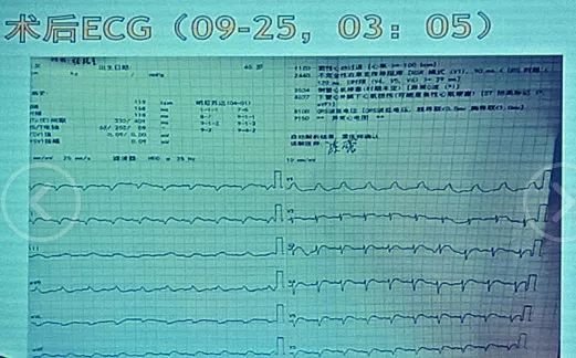 傷心街角戀人 视频截图