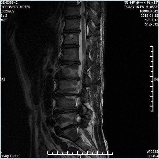 出嫁女 产品图片